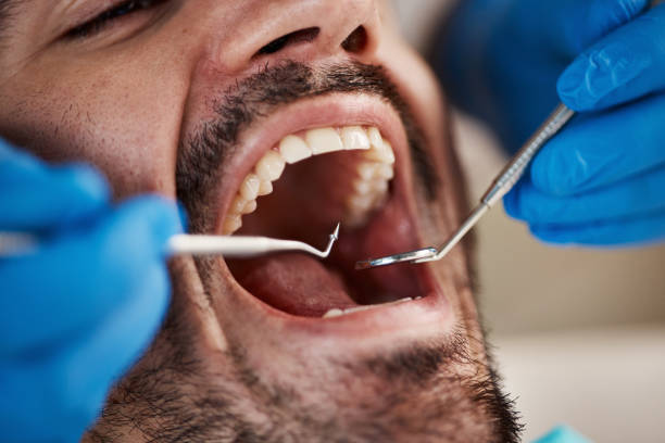 Best Emergency Dental Care for Broken or Chipped Teeth in Chico, TX