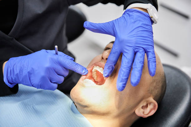 Best Emergency Gum Treatment in Chico, TX