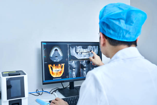 Best Emergency Tooth Extraction in Chico, TX